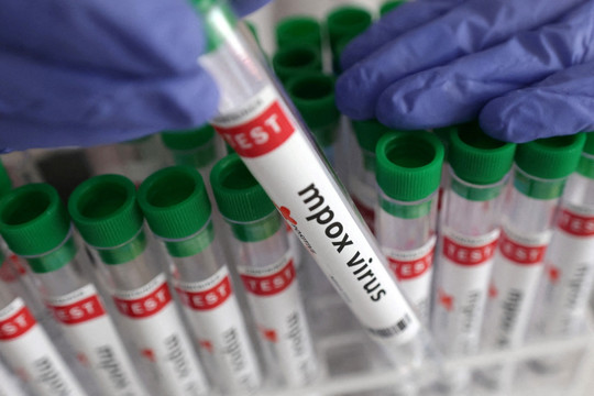Châu Phi được cam kết thêm 500.000 liều vaccine ngừa bệnh đậu mùa khỉ