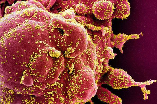 AI Trung Quốc phát hiện gần 162.000 virus RNA mới với tốc độ kỷ lục