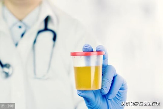 3 dấu hiệu bất thường của nước tiểu, cần cảnh giác nếu không muốn mắc bệnh