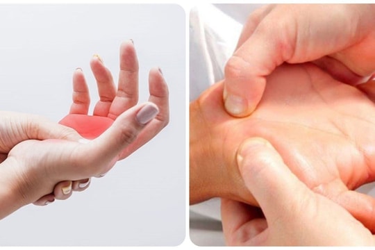 7 triệu chứng thiếu canxi ở người lớn