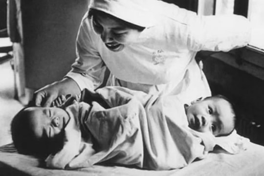 Ca mổ tách cặp song sinh Việt - Đức: Kỳ tích y học Việt Nam 37 năm trước