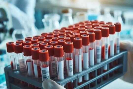 Hà Nội ghi nhận ca viêm não Nhật Bản đầu tiên trong năm, là trẻ 4 tháng tuổi