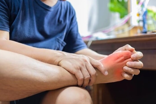 Hai dấu hiệu điển hình của bệnh Chikungunia để phân biệt với sốt xuất huyết