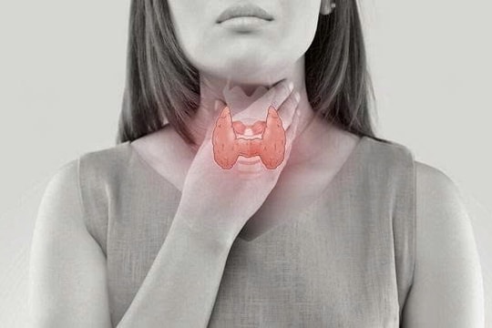 Nhân tuyến giáp: Có thực sự tan nhờ ăn uống và thảo dược?