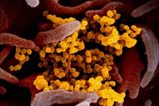 Biến thể COVID-19 'Ve sầu' né vaccine, lây nhanh tại Mỹ: Bộ Y tế cảnh báo gì?