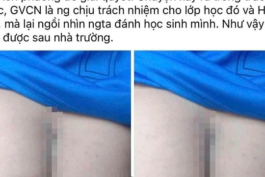 Vụ phụ huynh vào trường đánh học sinh: Tạm đình chỉ đứng lớp 2 giáo viên