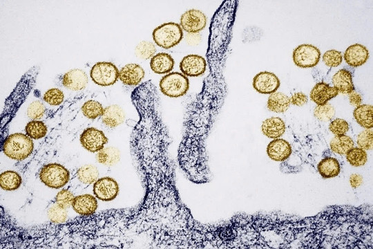 Bộ Y tế cảnh báo khẩn virus Hanta lây truyền từ chuột