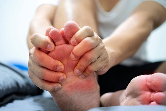 Kiêng đủ thứ vẫn tái phát gout: 5 sai lầm nhiều người mắc phải