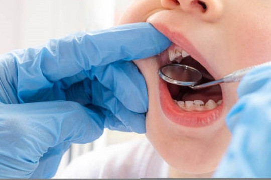 Khám sức khỏe toàn dân, TP.HCM phát hiện 24,9% học sinh sâu răng